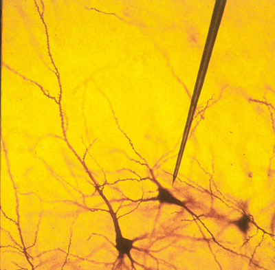 categories of neural prostheses: central nervous system, or peripheral nervous system, invasive or non-invasive. Where brain machine interfaces, brain computer interfaces, and neural prosthetics fall